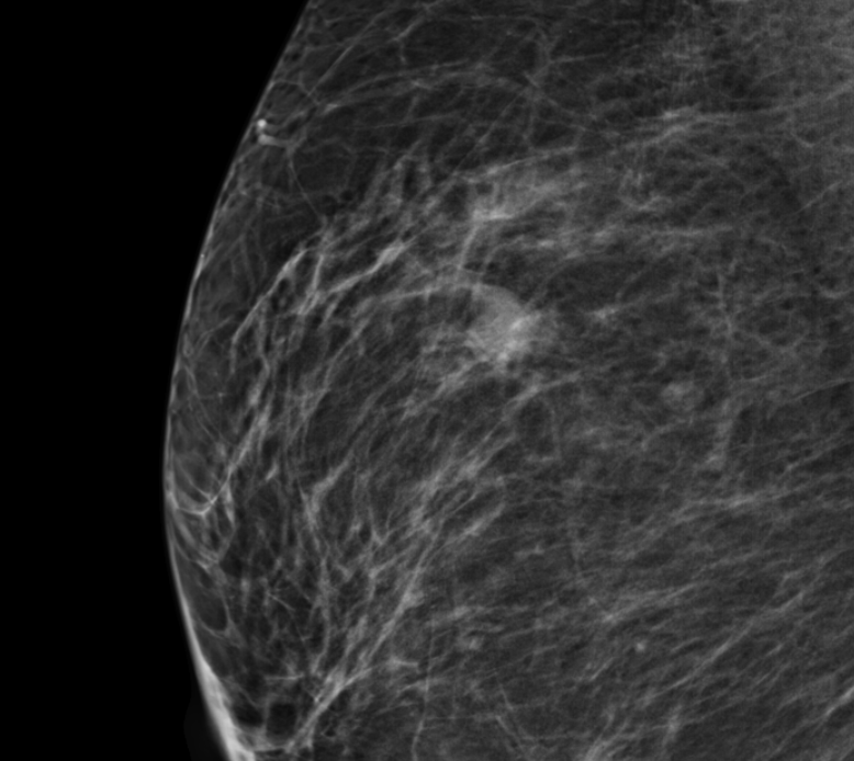 Modelos de Linguagem e Aprendizagem Federada para Laudos Médicos